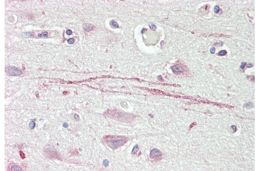 Immunohistochemistry - Anti-ASIC1 Antibody (A83063) - Antibodies.com