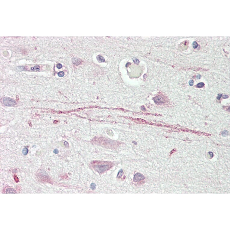 Immunohistochemistry - Anti-ASIC1 Antibody (A83063) - Antibodies.com