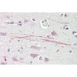 Immunohistochemistry - Anti-ASIC1 Antibody (A83063) - Antibodies.com