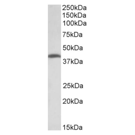 Western Blot - Anti-THNSL2 Antibody (A83064) - Antibodies.com