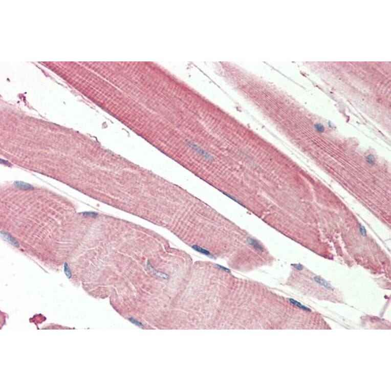 Immunohistochemistry - Anti-THNSL2 Antibody (A83064) - Antibodies.com