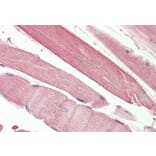 Immunohistochemistry - Anti-THNSL2 Antibody (A83064) - Antibodies.com