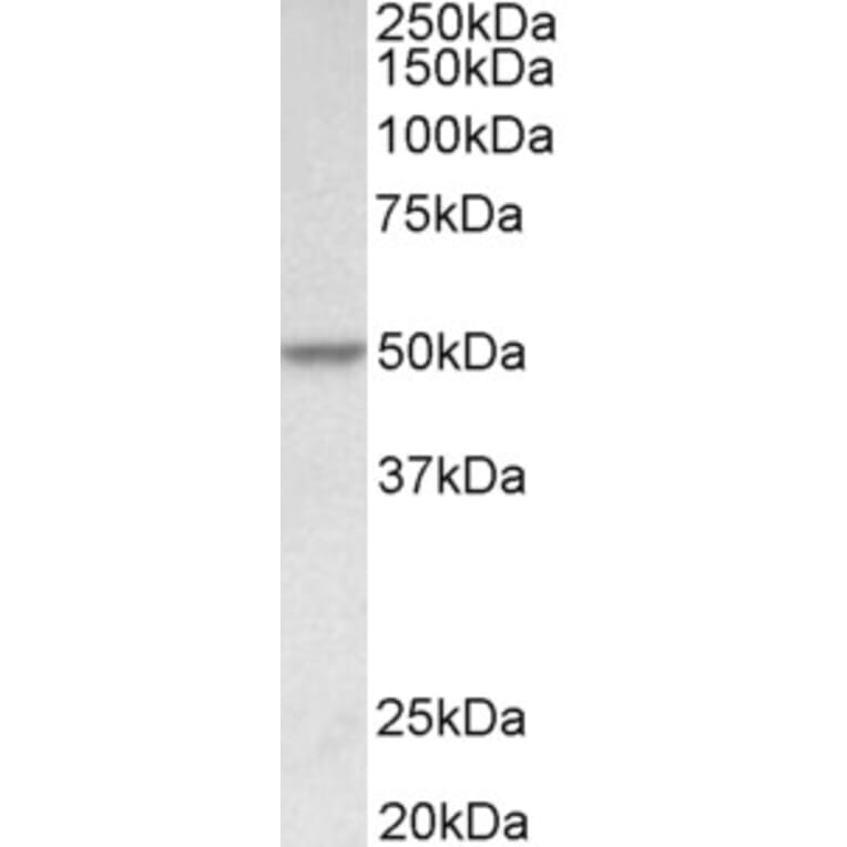 Western Blot - Anti-PDCD4 Antibody (A83068) - Antibodies.com