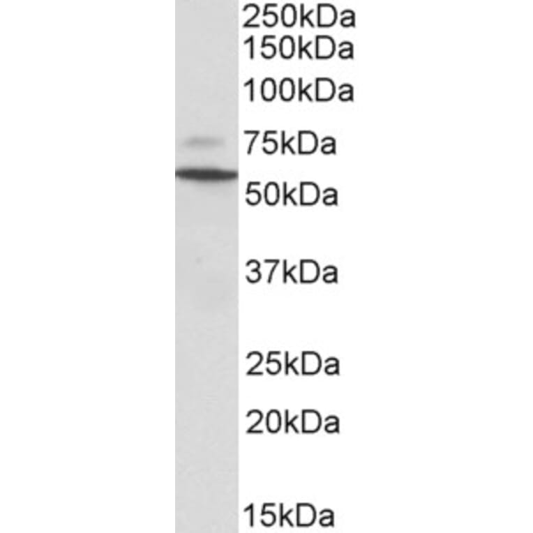 Western Blot - Anti-Peripherin Antibody (A83069) - Antibodies.com