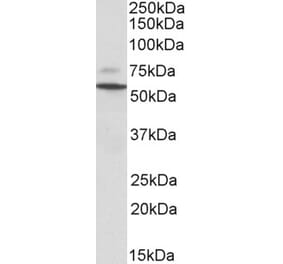 Western Blot - Anti-Prph Antibody (A83069) - Antibodies.com