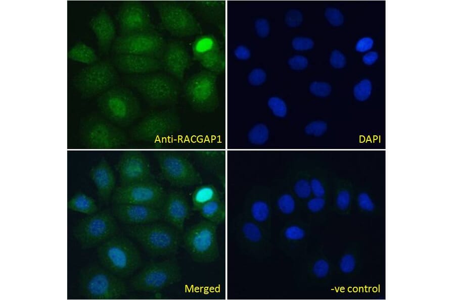 Immunofluorescence - Anti-RACGAP1/MGCRACGAP Antibody (A83070) - Antibodies.com