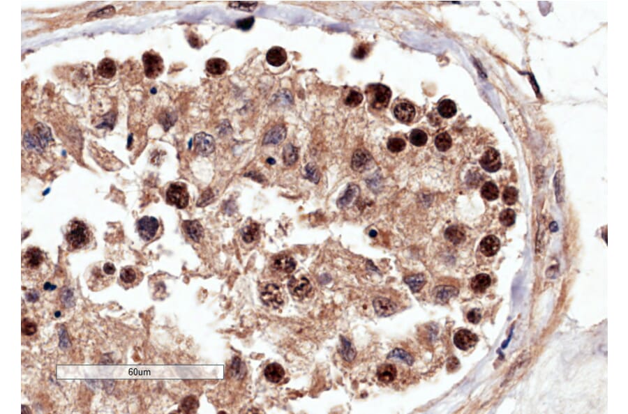 Immunohistochemistry - Anti-RACGAP1/MGCRACGAP Antibody (A83070) - Antibodies.com