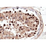 Immunohistochemistry - Anti-RACGAP1/MGCRACGAP Antibody (A83070) - Antibodies.com