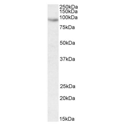 Western Blot - Anti-CIZ1 Antibody (A83071) - Antibodies.com