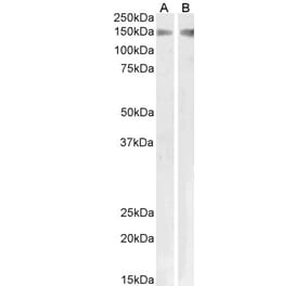 Western Blot - Anti-PLA2R1 Antibody (A83073) - Antibodies.com