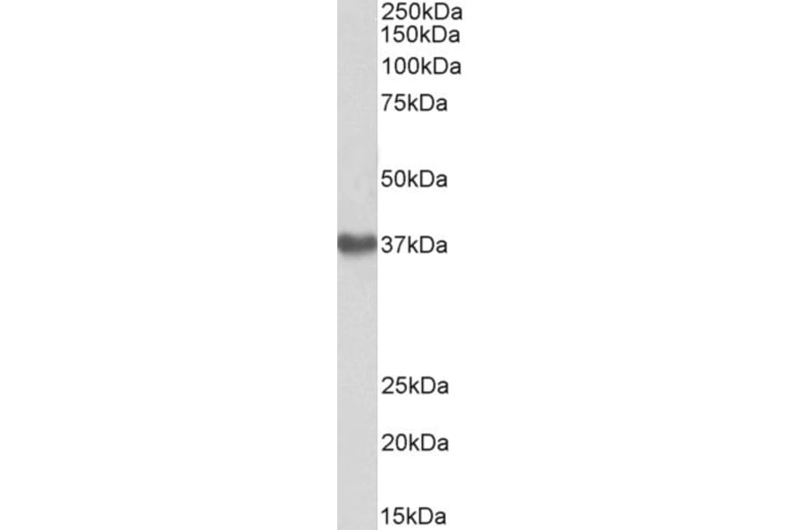 Western Blot - Anti-GNA12 Antibody (A83074) - Antibodies.com