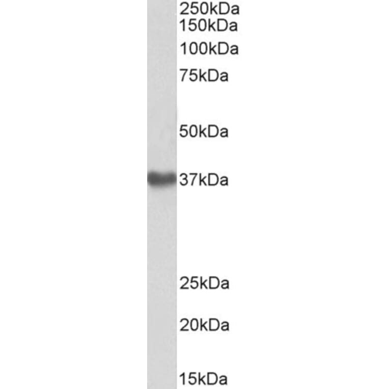 Western Blot - Anti-GNA12 Antibody (A83074) - Antibodies.com