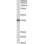 Western Blot - Anti-GNA12 Antibody (A83074) - Antibodies.com