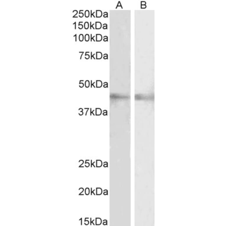Western Blot - Anti-RNF13 Antibody (A83075) - Antibodies.com