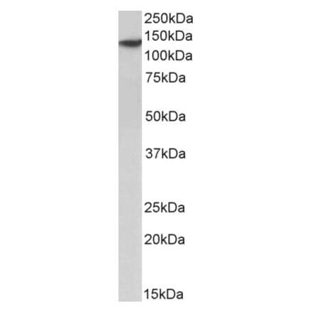 Western Blot - Anti-SP140 Antibody (A83076) - Antibodies.com