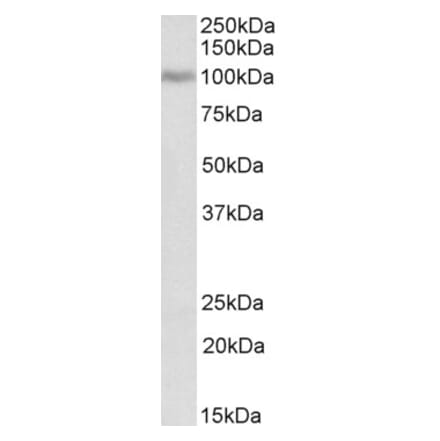 Western Blot - Anti-Periostin Antibody (A83077) - Antibodies.com