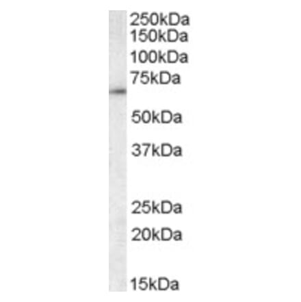 Western Blot - Anti-CCT3 Antibody (A83080) - Antibodies.com