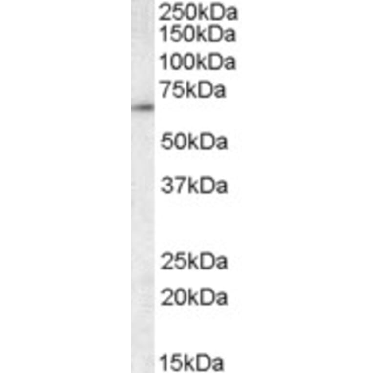 Western Blot - Anti-CCT3 Antibody (A83080) - Antibodies.com
