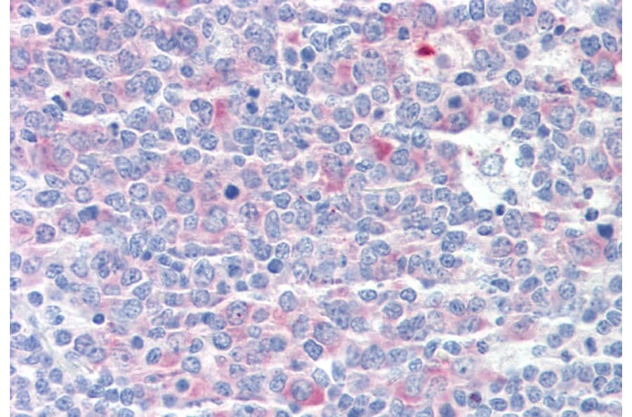 Immunohistochemistry - Anti-CCT3 Antibody (A83080) - Antibodies.com