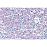 Immunohistochemistry - Anti-CCT3 Antibody (A83080) - Antibodies.com