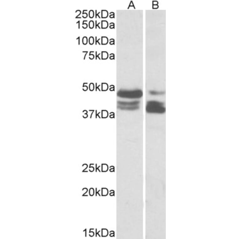 Western Blot - Anti-Perilipin 3 Antibody (A83081) - Antibodies.com