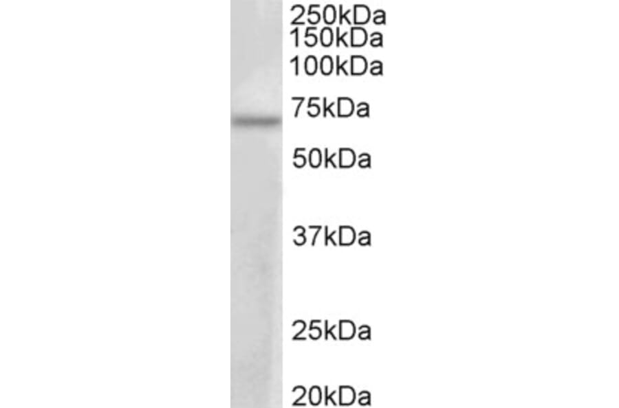 Western Blot - Anti-PRMT3 Antibody (A83082) - Antibodies.com