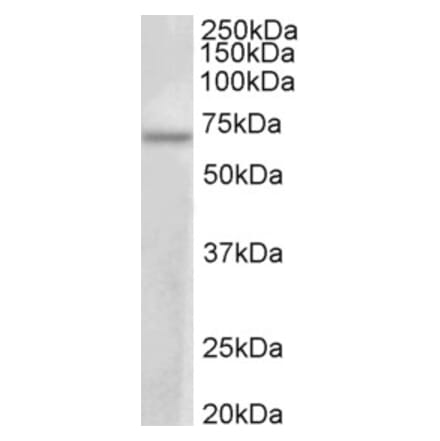 Western Blot - Anti-PRMT3 Antibody (A83082) - Antibodies.com