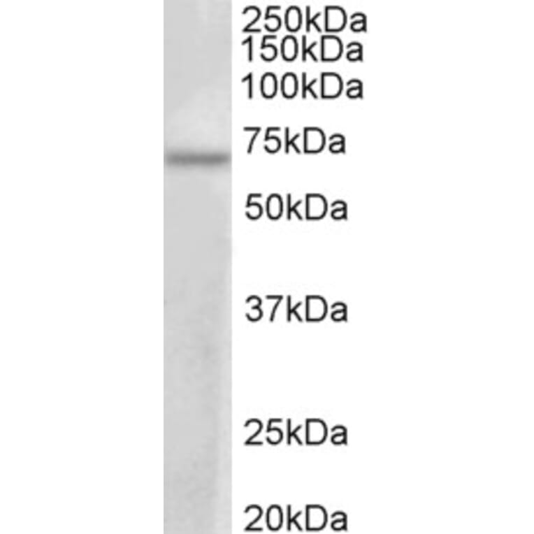 Western Blot - Anti-PRMT3 Antibody (A83082) - Antibodies.com