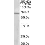 Western Blot - Anti-PRMT3 Antibody (A83082) - Antibodies.com
