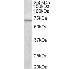 Western Blot - Anti-PRMT3 Antibody (A83082) - Antibodies.com