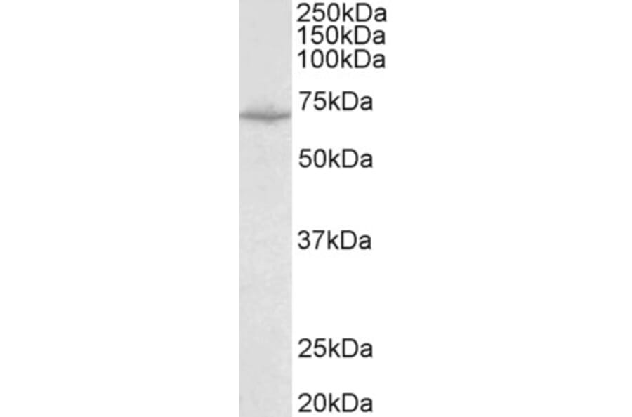 Western Blot - Anti-SLC6A8 Antibody (A83083) - Antibodies.com