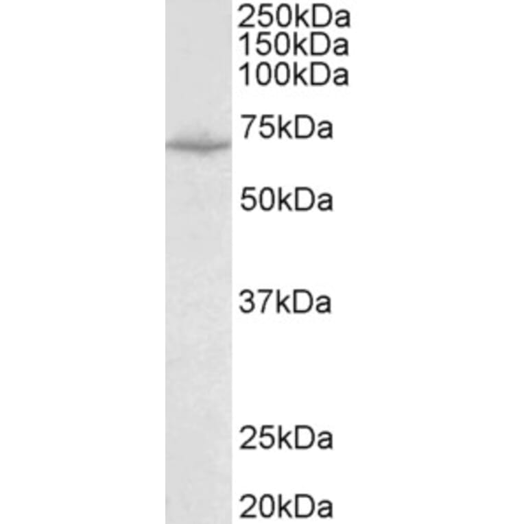 Western Blot - Anti-SLC6A8 Antibody (A83083) - Antibodies.com