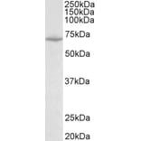 Western Blot - Anti-SLC6A8 Antibody (A83083) - Antibodies.com