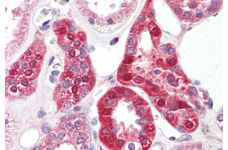 Immunohistochemistry - Anti-SLC6A8 Antibody (A83083) - Antibodies.com