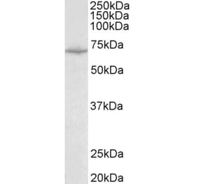 Western Blot - Anti-SLC6A8 Antibody (A83083) - Antibodies.com