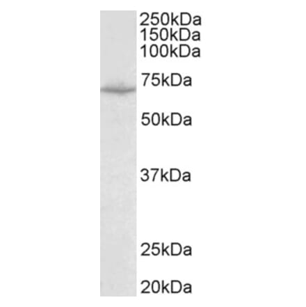 Western Blot - Anti-SLC6A8 Antibody (A83083) - Antibodies.com