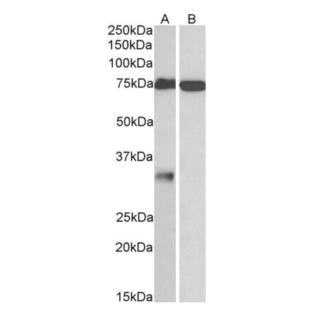 Western Blot - Anti-GPM6A Antibody (A83084) - Antibodies.com