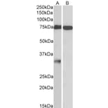 Western Blot - Anti-GPM6A Antibody (A83084) - Antibodies.com