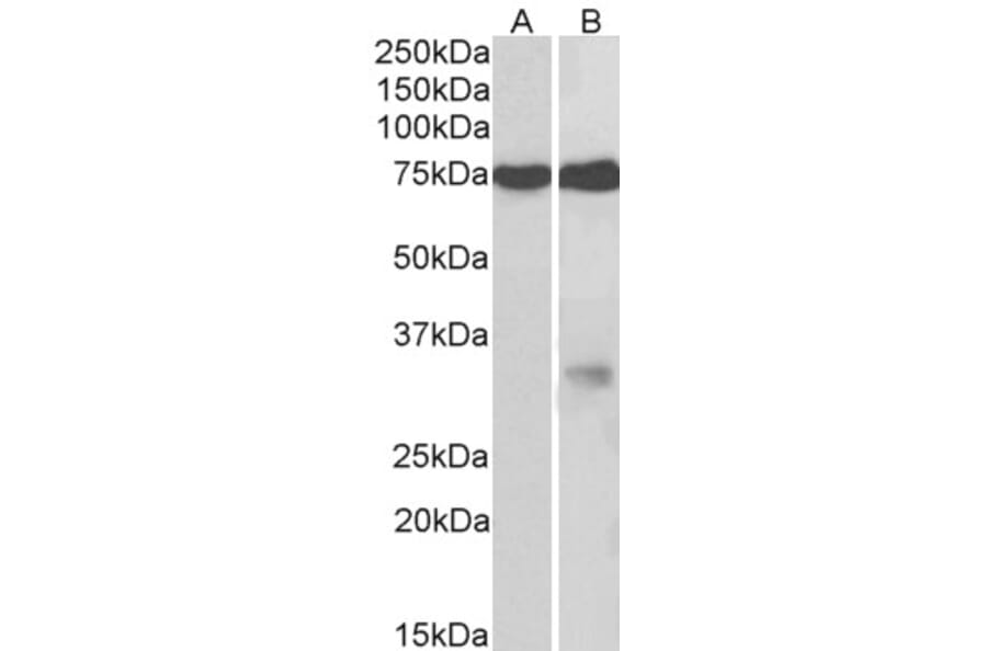 Western Blot - Anti-GPM6A Antibody (A83084) - Antibodies.com