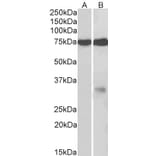 Western Blot - Anti-GPM6A Antibody (A83084) - Antibodies.com