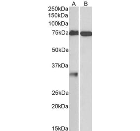Western Blot - Anti-GPM6A Antibody (A83084) - Antibodies.com
