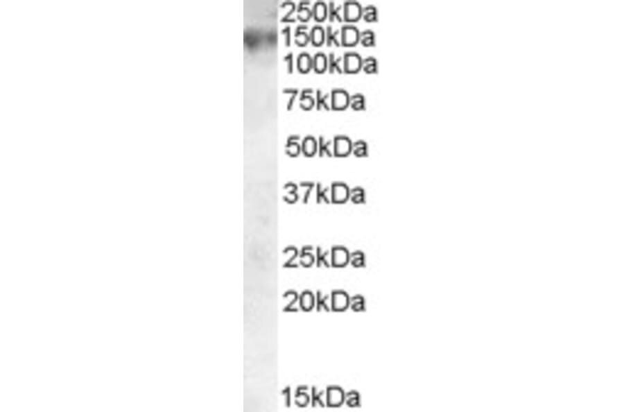 Western Blot - Anti-MRP1 Antibody (A83086) - Antibodies.com