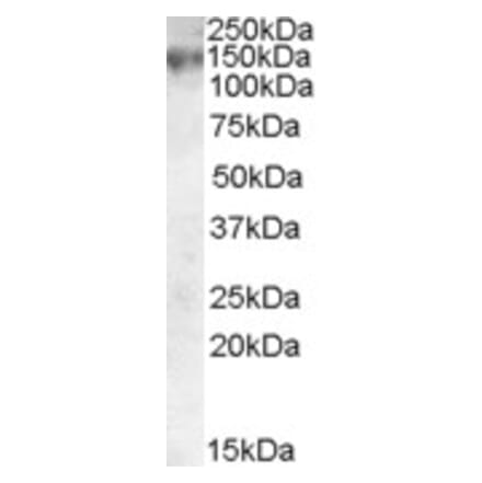 Western Blot - Anti-MRP1 Antibody (A83086) - Antibodies.com