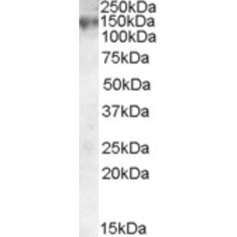 Western Blot - Anti-MRP1 Antibody (A83086) - Antibodies.com