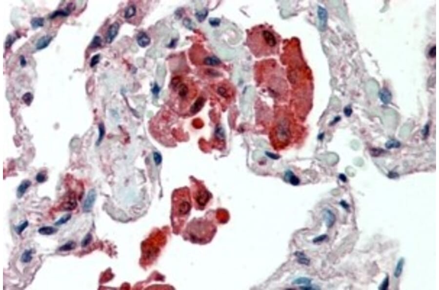 Immunohistochemistry - Anti-Insulin Degrading Enzyme/IDE Antibody (A83088) - Antibodies.com