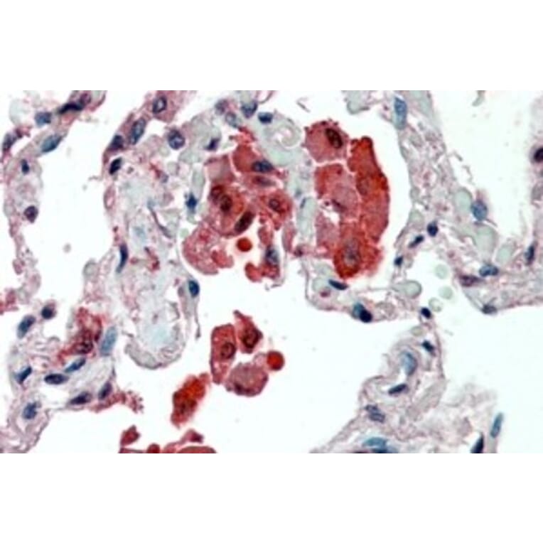 Immunohistochemistry - Anti-Insulin Degrading Enzyme/IDE Antibody (A83088) - Antibodies.com