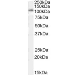 Western Blot - Anti-IDE Antibody (A83088) - Antibodies.com