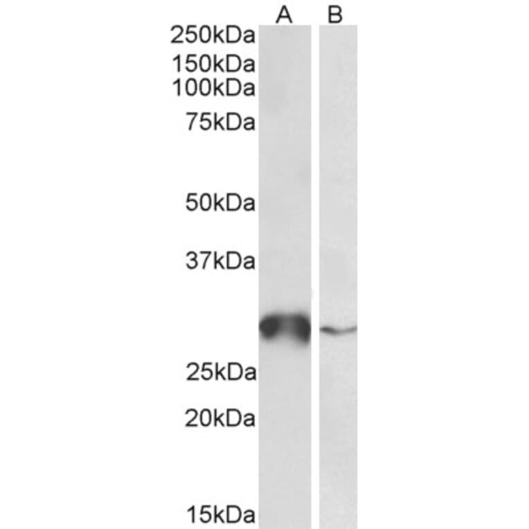 Western Blot - Anti-Glutathione S Transferase Omega 1/p28 Antibody (A83089) - Antibodies.com