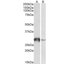 Western Blot - Anti-GSTO1 Antibody (A83089) - Antibodies.com
