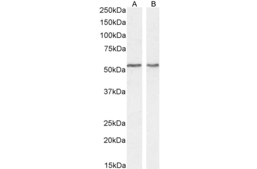 Western Blot - Anti-SEPT4 Antibody (A83090) - Antibodies.com